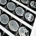 Wat is dopamine fasting en werkt het echt voor je mentale gezondheid?