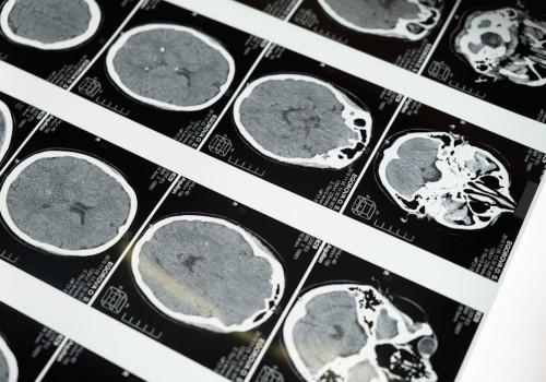 Wat is dopamine fasting en werkt het echt voor je mentale gezondheid?