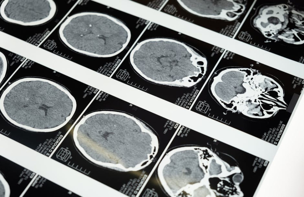 Wat is dopamine fasting en werkt het echt voor je mentale gezondheid?